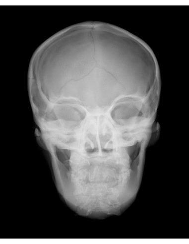 Simulatore per radiologia - Cranio...