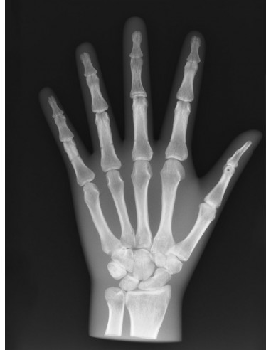 Simulatore per radiologia - Mano -...